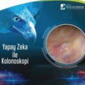 Yapay Zeka (CAD EYE) ile kolonoskopi   teknolojisi nedir?